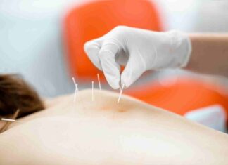 Les bienfaits de l’acupuncture pour la beauté