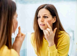 Comment gérer naturellement la peau grasse ?