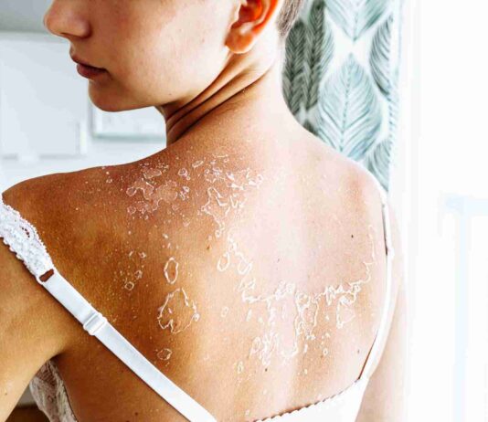 Comment traiter naturellement la peau sèche ?